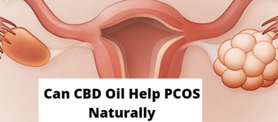 Can CBD Oil Help PCOS Naturally